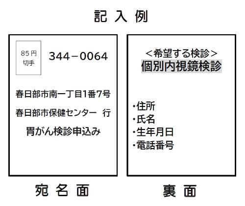 胃がん内視鏡検診申し込みはがき記入例