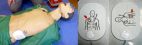 横たわったマネキン人形と電極パッド二枚の写真